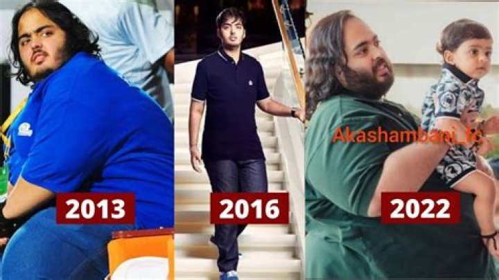 Anant Ambani's Condition: A Closer Look At His Health Journey