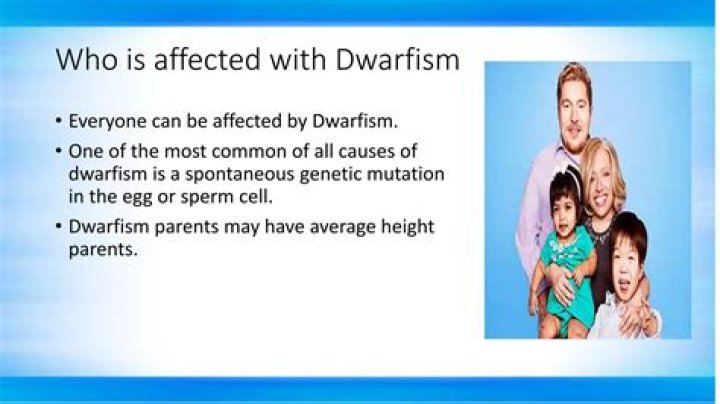 Are The Johnston Twins Affected By Dwarfism?