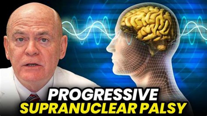 Billy Miller's Fight Against Progressive Supranuclear Palsy