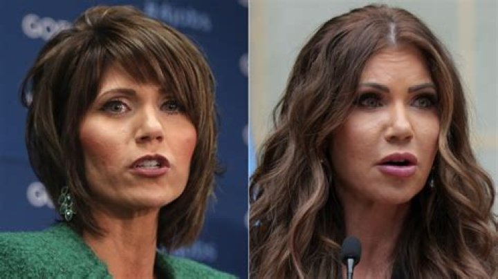 Exploring The Speculations Surrounding Kristi Noem's Plastic Surgery Journey