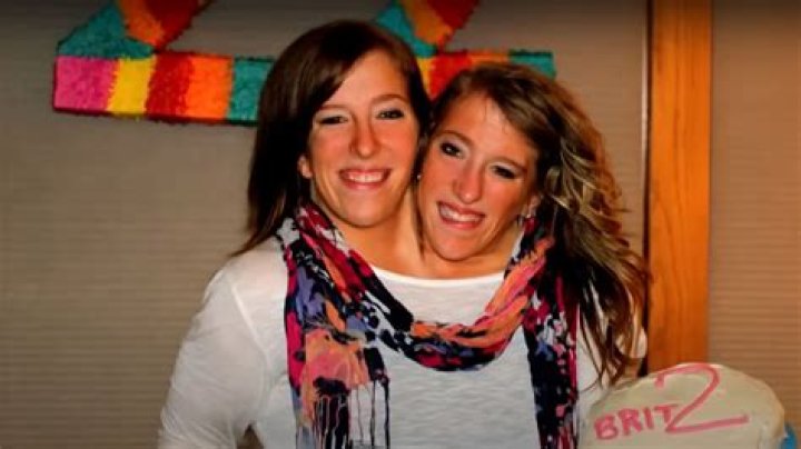 Extraordinary Pregnancy Journey: Conjoined Twins Abby And Brittany Hensel Expecting Twins