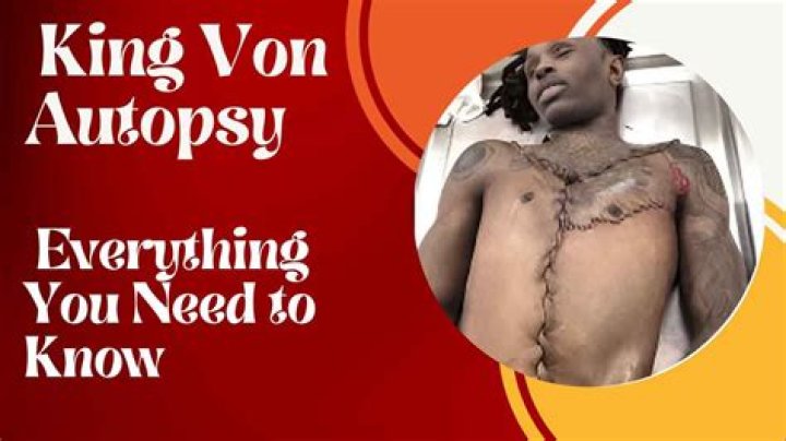 King Von's Shocking Autopsy Report: A Detailed Examination