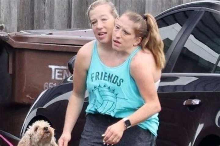 Remembering Abby And Brittany Hensel: The Journey Of Two Remarkable Lives