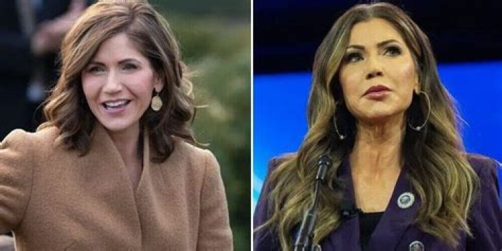 The Truth About Kristie Noem's Alleged Plastic Surgery
