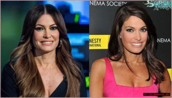 Transformative Journey: Kimberly Guilfoyle Before And After Pics