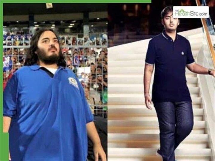 Understanding Anant Ambani's Health Journey