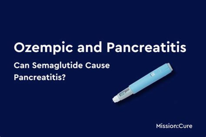 Understanding The Connection: Can Ozempic Cause Lupus?