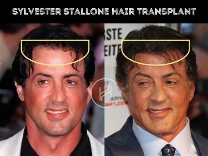 Unraveling The Age Of Sylvester Stallone: How Old Is He Really?