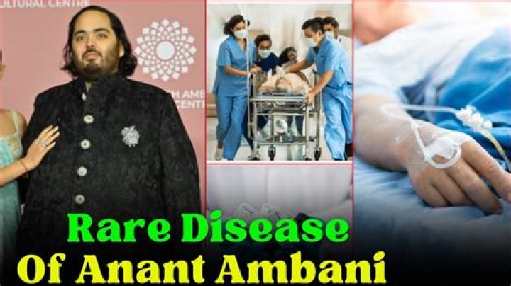 Unraveling The Health Condition Of Anant Ambani