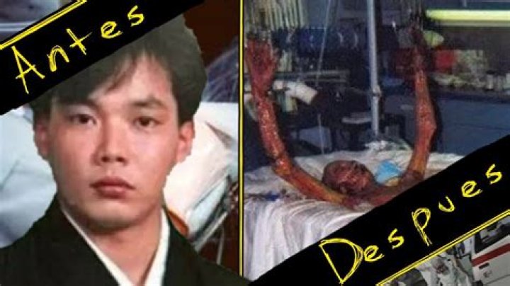 Unraveling The Mystery Of Hisashi Ouchi Leak: A Deep Dive Into A Tragic Incident