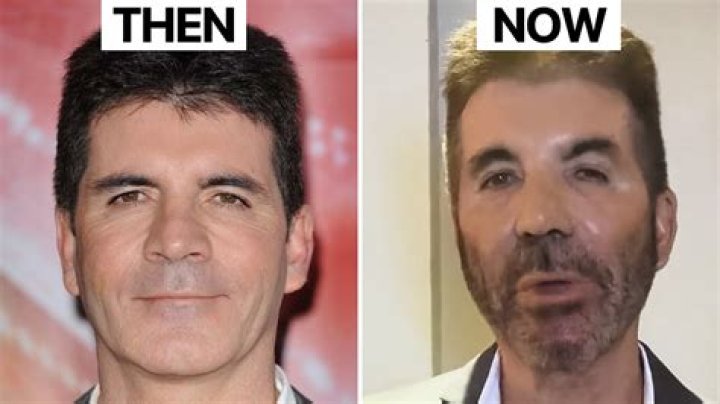Unraveling The Mystery: What Is Wrong With Simon Cowell's Son?