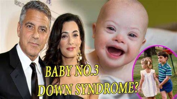 Unraveling The Truth: Does One Of George Clooney's Children Have Down Syndrome?