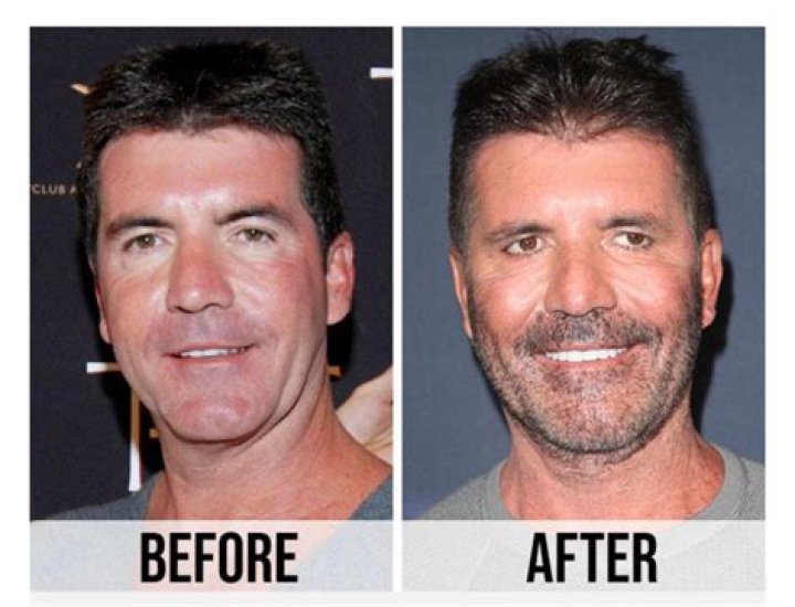 Unveiling Simon Cowell's Old Face: A Journey Through Time
