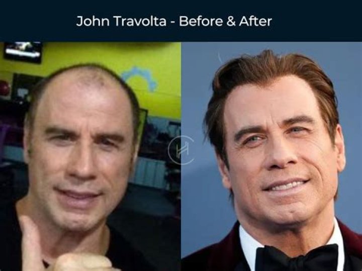 Unveiling The Journey Of John Travolta's Career