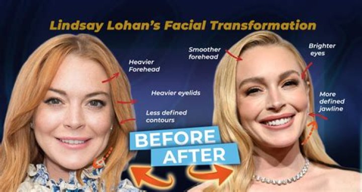 Unveiling The Mystery: Did Lindsay Lohan Have A Twin?