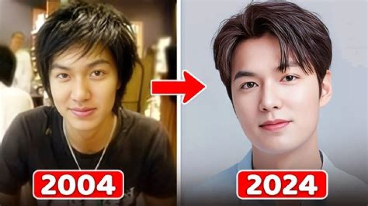 Unveiling The Truth Behind Kim Soo Hyun's Plastic Surgery