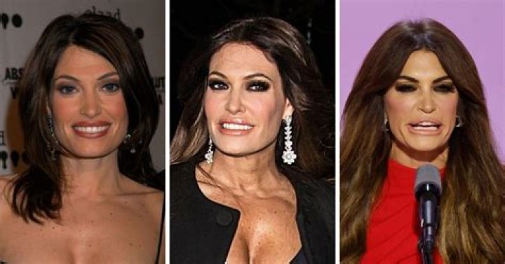 Unveiling The Truth Behind Kimberly Guilfoyle's Plastic Surgery Rumors