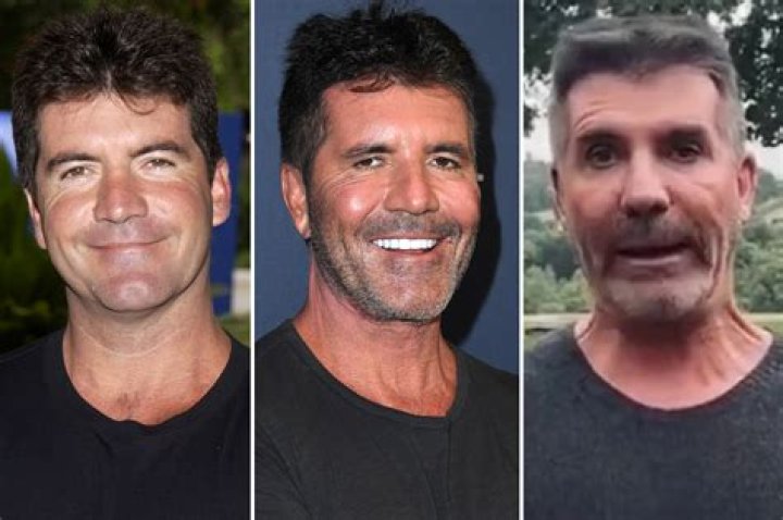 What Happened To Simon Cowell's Face? A Deep Dive Into The Controversy